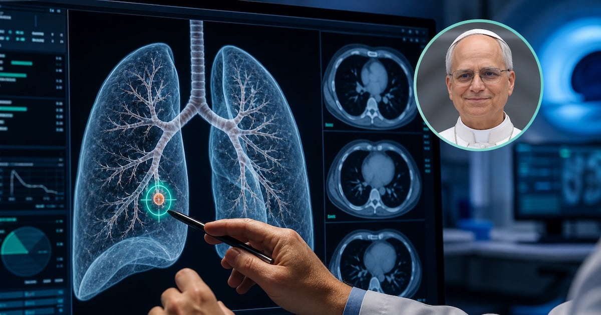 Por qué se decide operar un nódulo pulmonar de apenas tres milímetros